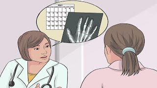 How to Know if You Sprained Your Finger [upl. by Llehsar]