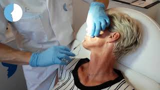 ENDOLIFTING  huidverbetering en natuurlijke lift IClinics [upl. by Masao]