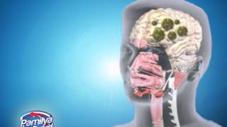 Kitchen mold toxins can affect human brain [upl. by Eveivaneg]