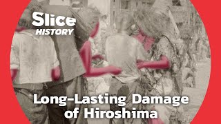 The Aftereffects ofAtomic Bombing on Human Body PART 3 I SLICE HISTORY [upl. by Zampino]