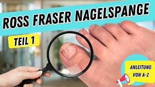 ROSS FRASER NAGELSPANGE  Teil 1  NAGELSPANGE anfertigen  NAGELSPANGE bei eingewachsenen Nägeln [upl. by Dnumyar]