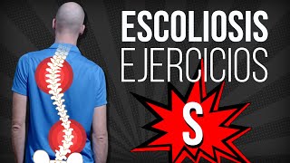 ESCOLIOSIS en S 👉 EJERCICIOS correctivos [upl. by Ibrad]