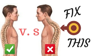 3 تمارين لعلاج تقوس الظهر الأتب kyphosis treatment [upl. by Poll]