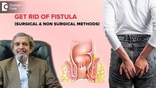 Fistula Surgery  Fistulectomy amp Fistulotomy Procedure  Dr Rajasekhar MR  Doctors Circle [upl. by Brittain]