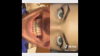 tiktok reached peak meme evolution once again pt2 [upl. by Yentrok759]