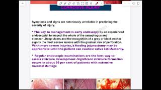 Esophagus Lec 2  First Part [upl. by Osrock40]