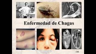 Enfermedad de Chagas la muerte silenciosa [upl. by Hinson]