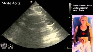 How to Perform Ultrasound of the Aorta STEP by STEP [upl. by Eiboh]