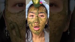 A MicroNeedling Face Mask [upl. by Justino]