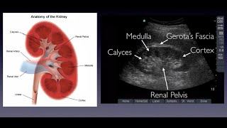 Introduction to Renal Ultrasound [upl. by Dorry]