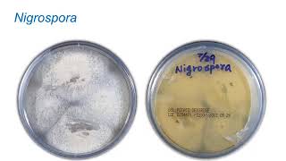 Identification of Melanized Dermatitiaceous Fungi Part 1 Hot Topic [upl. by Suedama]