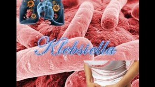 Klebsiella [upl. by Snider]