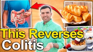 How to Treat Ulcerative Colitis  Foods and Natural Remedies to Cure Ulcers in the Colon [upl. by Whitney949]