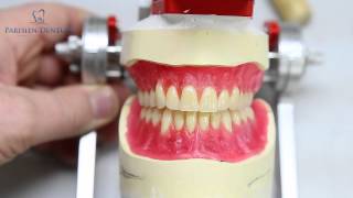 How to Process an Esthetic Denture [upl. by Mathias452]