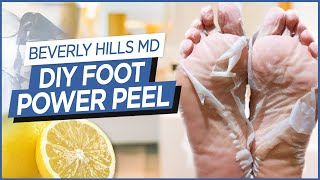 How To Make DIY Foot quotPower Peelquot Easy to make  Beverly Hills MD Beauty Tips [upl. by Amsirhc]