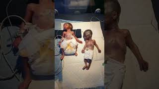 Twins  Twin Pregnancy  Babies in the womb  Multiple Pregnancy shortsfeed twins baby fyp [upl. by Barber197]