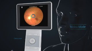 Horus DEC200 Digital 5MP eye fundus camera │ MiiS [upl. by Delmar]