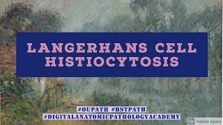 Langerhans Cell Histiocytosis [upl. by Shriver163]