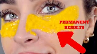 I Removed DARK CIRCLES in 5 Days with NATURAL INGREDIENTS DIY REMEDY 100 WORKS puffywrinkles [upl. by Svoboda]