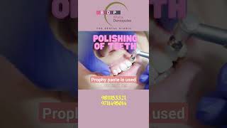 See the method of Polishing the teeth with prophy paste [upl. by Leina380]