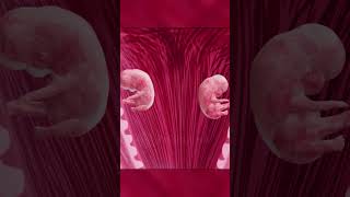 Twin wonders in mothers womb  Types of Twins  Twin baby pregnancy twins twinsbaby [upl. by Byrd]