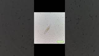 A kind of Rotifer Is it Rotaria sp Rotifer Rotaria [upl. by Iahs]