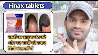 Finax tablet use dose benefits and Side effects full review in hindiFinasteride1mg tablet [upl. by Tung]