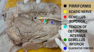 Dissection Gluteal Region [upl. by Jandel]