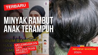 Unboxing amp Review Minyak Rambut Anak Ampuh Menebalkan Rambut [upl. by Ssegrub95]