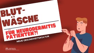 Blutwäsche Eine Behandlungsoption für Neurodermitis Patienten [upl. by Nyleak]