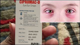 Eye Drops red cause how to drops [upl. by Culbertson]