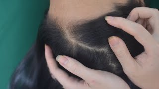 ASMR Real Person Scalp Scratching No Talking Hair Parting With Tools Sounds For Relieve Stress [upl. by Robena]