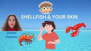 Shellfish Allergy and Skin Reactions Doctor Breaks It Down 2024 [upl. by Novia]