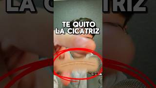 TE QUITO LA CICATRIZ asmr shorts asmrvideo comedia [upl. by Eednim38]