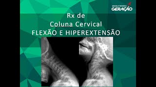 Radiografia da Coluna Cervical Dinâmicas  Flexão e Hiperextensão [upl. by Jaala847]