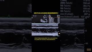 LV Mmode Measurements echocardiography echo cardiology ultrasound cardiachealth hearthealth [upl. by Nomaj834]