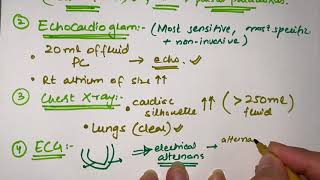 DIAGNOSIS OF CARDIAC TAMPONADE  MEDICINE with DR SHAMAMA [upl. by Eelibuj]