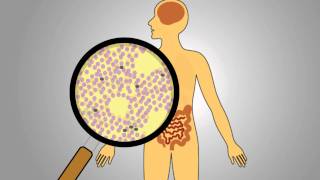 Acute Radiation Syndrome [upl. by Radke]