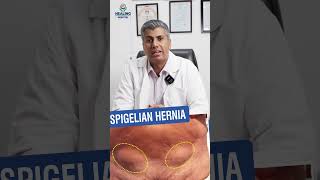 Common Types of Hernia And Its Types hernia herniatreatment [upl. by Frodine644]