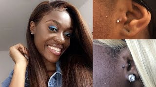 Tragus Got Infected Video  Pictures Inside [upl. by Norha]