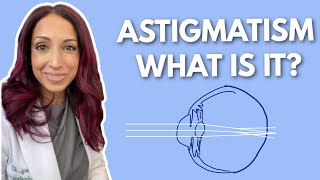 What Is Astigmatism Eye Doctor Explains [upl. by Ellivro]