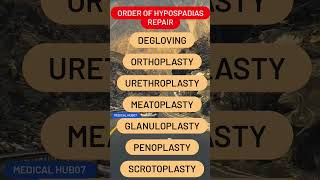 Order of Hypospadias Repair [upl. by Sinoda]