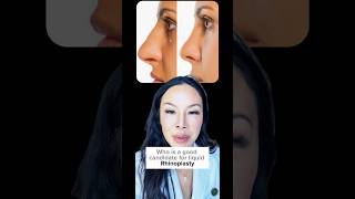 These are the major benefits of non surgical liquid Rhinoplasty [upl. by Weslee]