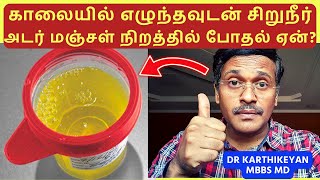 urine infection treatment [upl. by Allerim]