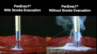 IC Medicals PenEvac1 Surgical Smoke Evacuation [upl. by Eldridge]