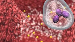 Bacterial infection and host response [upl. by Mundford]