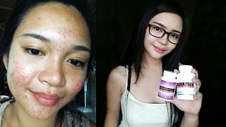 Luxxe White Enhanced Glutathione Most Effective Skin Whitening [upl. by Triny]