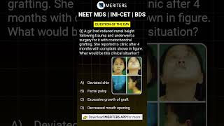 NEET MDS  INICET MDS  PSC  BDS  Most Important Questions neetmds2025 mdsprep [upl. by Ahsia]