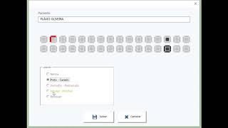 Planilha Odontograma em Excel [upl. by Diamond]