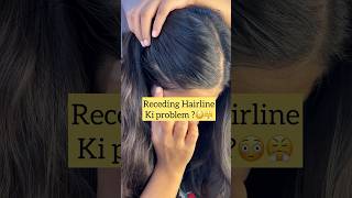 Receding hairline ki problem 🙁 naturally solution haircare hairline hairstyle haircare tip [upl. by Horwitz]